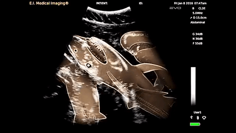 shark sonogram
